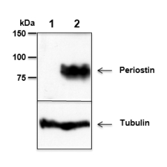 Mouse Periostin is detected by immunoblotting using anti-Periostin, mAb (Stiny-1) (Prod. No AG-20B-0033).<br />
Whole tissue extracts from mouse liver (lane 1) or mammary tumor (lane 2) were separated by SDS-PAGE under reducing conditions, transferred to