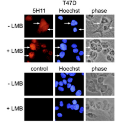 Immunofluorescence using anti-PARP-10 [ARTD10] (human), mAb (5H11). <b>Method:</b> T47D mammary carcinoma cells were stained by indirect immunofluorescence and analysed. Prior to fixation and staining, the cells were treated with or without 50nm leptomyci