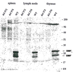 Western blot using anti-Bmf (mouse/rat), mAb (17A9) (Prod. No. AG-20T-0131) detecting endogenous Bmf in mouse spleen, lymph node and thymus as two bands of ~25 and ~30 kDa, but not in tissues from two knock-out Bmf strains del 372 and del 376.