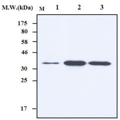 Western blot analysis using anti-HES1, mAb (7H11) (Prod. No. AG-20T-0400) in cell lysates. Lane1: HeLa cell lysate; Lane 2: HT29 cell lysate; Lane 3: BeWo cell lysate.