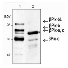 Western blot analysis using anti-&beta;-Pix (mouse), pAb (Prod. No. AG-25A-0006).<br />
1: Mouse brain lysates (30&mu;g).<br />
2: NIH3T3 whole cell lysates (30&mu;g).<br />
<br />
* &beta;-Pix is a major isoform in NIH3T3 lysates, while other &beta;-Pix 