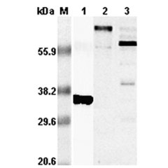 Western blot analysis using anti-RANKL (human), pAb (Prod. No. AG-25A-0016) at 1:5,000 dilution.<br />
1. Recombinant hRANKL (His-tagged).<br />
2. Human RANKL (GST-tagged).>br />
3. Con-A activated human T lymphocytes lysate.