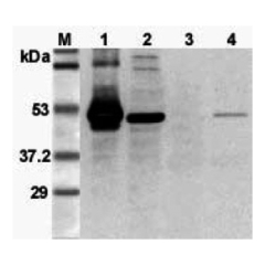 Western blot analysis using anti-FOXP3 (mouse), pAb (Prod. No. AG-25A-0020) at 1:3'000 dilution.<br />
1: Mouse FOXP3 (His-tagged).<br />
2: Transfected mouse FOXP3 cell lysate (HEK 293).<br />
3: Mouse T lymphocyte (CD4+) cell lysate.<br />
4: PHA treate