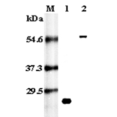 Western blot analysis using anti-RANK (human), pAb (Prod. No. AG-25A-0021) at 1:5,000 dilution.<br />
1: Recombinant human RANK (His-tagged).<br />
2: Human RANK (Fc protein).