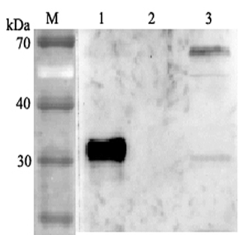 Western blot analysis using anti-ANGPTL4 (human), pAb (Prod. No. AG-25A-0038) at 1:2'000 dilution.<br />
1: Human ANGPTL4 (FLAG<sup>®</sup>-tagged).<br />
2: Human ANGPTL6 (FLAG<sup>®</sup>-tagged).<br />
3: HepG2 cell lysate.