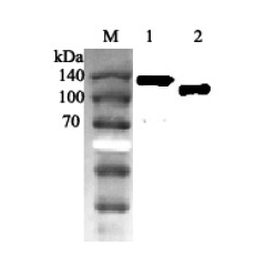 Western blot analysis using anti-ACE2 (human), pAb (Prod. No. AG-25A-0042) at 1:2'000 dilution.<br />
1: Human ACE2 Fc-protein.<br />
2: Human ACE2 (ED) (FLAG<sup>®</sup>-tagged).