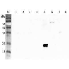 Western blot analysis using anti-ANGPTL4 (human), pAb (Prod. No. AG-25A-0055) at 1:2'000 dilution.<br />
1: Human ANGPTL1 (FLAG<sup>®</sup>-tagged).<br />
2: Human ANGPTL2 (FLAG<sup>®</sup>-tagged).<br />
3: Human ANGPTL3 (FLAG<sup>®</sup>-tagged).<br />
