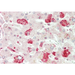 Immunohistochemical staining of ANGPTL3 using anti-ANGPTL3 (CCD) (human), pAb (Prod. No. AG-25A-0060) in human liver tissue (5&micro;g/ml).<br /> This antibody has been tested in immunohistochemistry, analyzed by an anatomic pathologist and validated for 