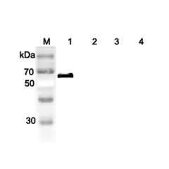 Western blot analysis of human DLL1 using anti-DLL1 (human), pAb (Prod. No. AG-25A-0062) at 1:2,000 dilution.<br />
1. Recombinant human DLL1 (FLAG<sup>®</sup>-tagged).<br />
2. Recombinant human DLL4 (Fc protein) (Negative control).<br />
3. Recombinant 