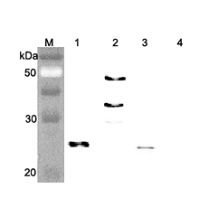 Western blot analysis of human FGF21 using anti-FGF-21 (human), pAb (Prod. No. AG-25A-0074) at 1:4,000 dilution..<br /> 1. Recombinant human FGF21 (FLAG-tagged).<br /> 2. Recombinant human FGF21 (Fc protein).<br /> 3. Recombinant human FGF21 (His-tagged).