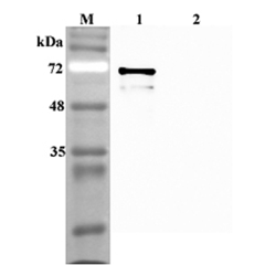 Western blot analysis using anti-Sirtuin 1 (human), pAb (Prod. No. AG-25A-0082) at 1:4'000 dilution.<br />
1: Human Sirtuin 1 (His-tagged).<br />
2: Human FTO (His-tagged) (negative control).