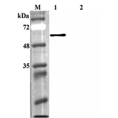 Western blot analysis using anti-FTO (human), pAb (Prod. No. AG-25A-0084) at 1:4'000 dilution.<br />
1: Human FTO (His-tagged).<br />
2: Human Sirtuin 1 (His-tagged) (negative control).