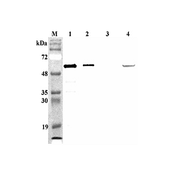 Western blot analysis of mouse FTO using anti-FTO (mouse), pAb (Prod. No. AG-25A-0089) at 1:4,000 dilution.<br /> 1. Recombinant mouse FTO (His-tagged) (100ng).<br /> 2. Recombinant human FTO (His-tagged) (100ng).<br /> 3. Recombinant hFGF19 (His-tagged) 