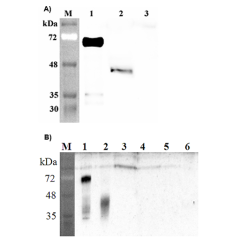 Western blot analysis of human DLK1 using anti-DLK1 (human), pAb (Prod. No. AG-25A-0091) at 1: 2,000 dilution.<br />
A.<br />
1. Human DLK1 (Fc protein).<br />
2. Transfected human DLK1 full length cell lysate (HEK 293).<br />
3. Mock Transfected HEK293 c