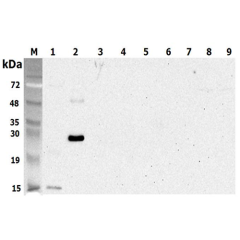 Western blot analysis using anti-CTRP5 (human), pAb (Prod. No. AG-25A-0103) at 1:5'000 dilution.<br />
1: Human CTRP5 (tGD) (His-tagged).<br />
2: Human CTRP5 (His-tagged).<br />
3: Human CTRP5 (GD) (His-tagged) (negative control).<br />
4: Human CTRP6 (H