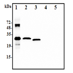 <b>Western blot analysis using anti-IL-37 (human), pAb (Prod. No. AG-25A-0111) at 1:2.000 dilution:</b><br />1. Recombinant human IL-37-His (50ng)<br />2. Human IL-37-FLAG transfected HEK293 cell lysate(100&micro;g)<br />3. Human IL-37-tag free transfecte