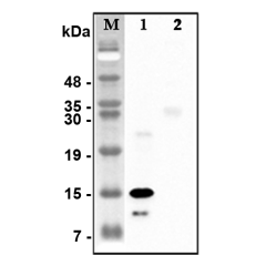 Western blot analysis of recombinant human CTRPs using anti-CTRP5 (human), pAb (Prod. No. AG-25A-0116) at 1:4,000 dilution.<br />1: Recombinant human CTRP5 protein (His-tagged).<br />2: Unrelated recombinant protein (His-tagged).