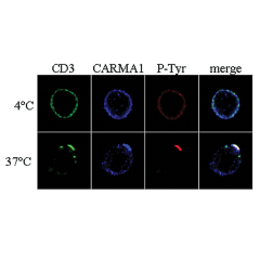 Immunocytochemistry analysis of CARMA1 using anti-CARMA1, pAb (AL220) (Prod. No. AG-25B-0004V). <br /> <strong>Method:</strong> Human T cells (clone 6396p5.1.2) were incubated with anti-CD3, mAb for 20 min. on ice, followed by incubation with secondary go