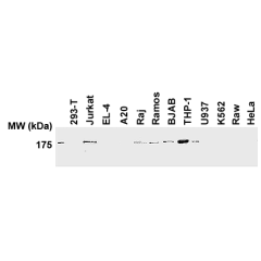 Western blot analysis of human and mouse cell lines using anti-human NLRP1/NALP1 antibody (AL176) (Prod. No. AG-25B-0005).<br /><strong>Method:</strong> Total protein extracts (20&mu;g) from various human (293-T, Jurkat, Raj, Ramos, BJAB, THP-1, U937, K56