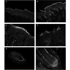 Immunohistochemical staining of repetin using anti-Repetin, pAb (AF646) (Prod. No. AG-25B-0017) and FITC-labeled anti-rabbit IgG antibody on frozen section of human skin (A), human foreskin (B), human tongue (C and D) and human hair follicles (E and F).