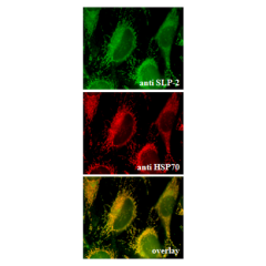 Endogenous SLP-2 is localized to the mitochondria (Immunocytochemical staining). <br /> Endogenous SLP-2 (green) (up) and endogenous mitochondrial HSP70 (red) (middle) were detected in methanol fixed HeLa cells using anti-SLP-2, pAb (Prod. No. AG-20B-0019