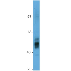 anti-GLUT2 (human), pAb (IN117)