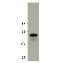 anti-GLUT2 (rat), pAb (IN119)