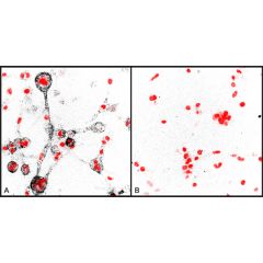 Immunocytochemical staining of  collagen degradation by human MDA-MB-231 breast cancer cells embedded in a 3D typeI collagen matrix using anti-Collagen Type 1 (¾ fragment), pAb (Prod. No. AG-25T-0116). Cells have been treated with non-targeting siRNA(A) o