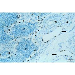 anti-PROX1, pAb