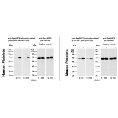 Western blot: Human (5μg protein/lane) and mouse (8μg protein/lane) platelets were either not stimulated (-) or were incubated with 5μM Forskolin for 1 min (+). Western blots at the indicated dilutions were performed using anti-RasGRP2 (phosphorylated) (p