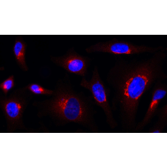 Rab1-GTP is detected by immunocytochemistry using anti-Rab1-GTP, mAb (ROF7) (Prod. No. &nbsp;AG-27B-0006). <br /><strong>Method:</strong> HeLa cells are grown in standard culture conditions, fixed with paraformaldehyde (3%), permeablized in  PBS+ BSA 0.2 