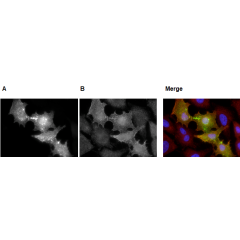 Palmitoylated PSD95 is detected by immunocytochemistry using anti-PSD-95 (palmitoylated), mAb (rec.) (PF11) (Prod. No AG-27B-0021).<br /> <b>Method:</b> HeLa cells were cotransfected with DHHC2 (palmitoylating enzyme) + PSD95-GFP (A) or DHHC2 (palmitoylat