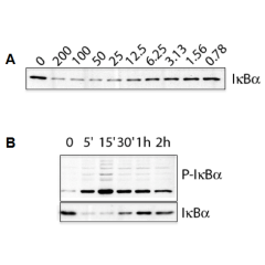 IL-1&beta; (human) (rec.) (untagged)