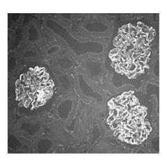 Immunocytochemical analysis of Actinin-4 distribution in rat kidney using anti-&alpha;-Actinin-4, pAb (IG-701) (AG-25T-0107). Glomeruli are strongly labeled (frozen sections of formaldehyde perfused tissue (dilution 1:1600)).