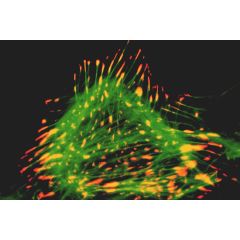 Immunocytochemical staining of a rat cardiac fibroblast using anti-Lipoma Preferred Partner, pAb (IG-817) (Prod. No. AG-25T-0106) (LPP; red fluorescence) and a green-fluorescent phalloidin derivative staining filamentous actin. LPP is a protein related to