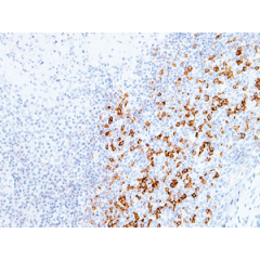 PD-1 receptor-induced CD4 T cell activation and proliferation by PD-1 (mouse), mAb (blocking) (1H10) (AG-20B-0075).<br /><b>Method:</b> Magnetic bead affinity purified CD4+ T cells from C57BL/6 mice are stimulated <i>in vitro</i> with PD-1 (mouse), mAb (b