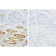 Human on Human Immunodetection Kit