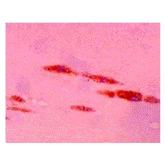 Immunohistochemical staining of MDA-modified protein in atherosclerotic aorta using anti-MDA, mAb (1F83).