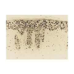 Immunohistochemical staining of epidermis from hairless mouse by chronic UVB irradiation after 4 weeks of treatment using anti-8-OHdG, mAb (N45.1).