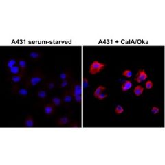 Immunocytochemistry of serum-starved A431 cells nontreated or treated with Calyculin A/ Okadaic Acid, using RevMAb Clone RM102 at 1/500 dilution (followed by PE conjugated secondary antibody, red) and DAPI (blue).