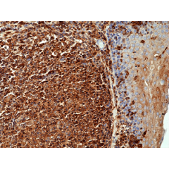Immunohistochemical staining of formalin fixed and paraffin embedded human tonsil tissue using Anti-beta actin Rabbit Monoclonal Antibody (Clone RM112) at a 1:1000 dilution.