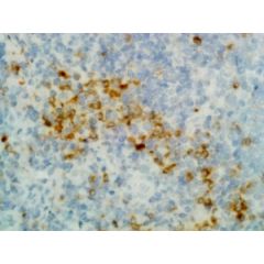 ELISA of mouse immunoglobulins shows RMG07 reacts to mouse IgG1, IgG2a, IgG2b, and IgG3; no cross reactivity with IgM, IgA, IgE, human IgG, rat IgG, and rabbit IgG. The plate was coated with 50 ng/well of different immunoglobulins. 500ng/mL, 200 ng/mL, or