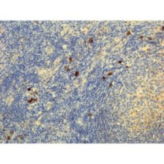 Immunohistochemistry of Human Lymphoid Tissue using Anti-Human IgG3 antibody RM119.