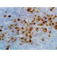 Immunohistochemistry of Human Tonsil using Anti-Kappa Light Chain antibody RM126.