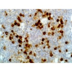 Immunohistochemical staining of formalin fixed and paraffin embedded human tonsil tissue section using anti-human Ig lambda light chain rabbit monoclonal antibody (Clone RM127).