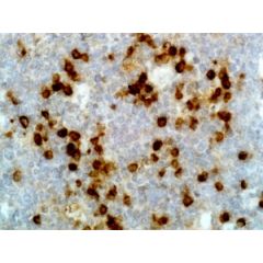 Immunohistochemistry of Human Tonsil using Anti-Kappa Light Chain antibody RM126.