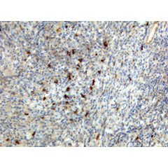 Immunohistochemistry of Human Lymphoid Tissue using anti-Human IgA antibody RM128.