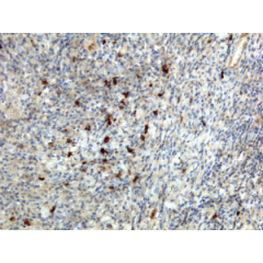 Sandwich ELISA using RM121 as the capture antibody (100ng/well), and Biotinylated anti-human light chains ( κ+ λ) antibody RM129 as the detection antibody, followed by an alkaline phosphatase conjugated streptavidin.