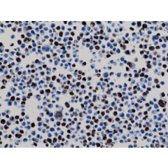Immunohistochemistry staining of 293T cells expressing His-Tag nuclear protein X, using anti-His-Tag antibody, RM146.