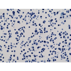 Immunocytochemical staining of HeLa cells, using anti-GAPDH RevMAb Clone RM114 at 1/200 dilution (red). Nuclei have been labeled with DAPI (blue).